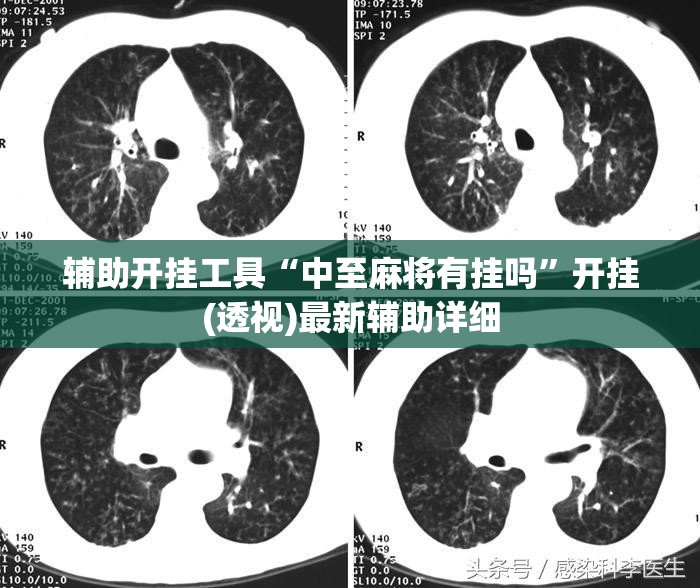 辅助开挂工具“中至麻将有挂吗”开挂(透视)最新辅助详细