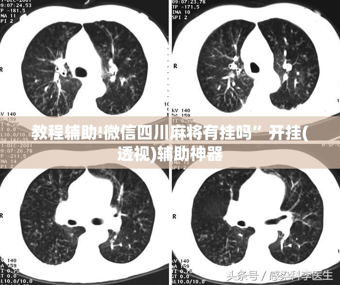 教程辅助!微信四川麻将有挂吗	”开挂(透视)辅助神器