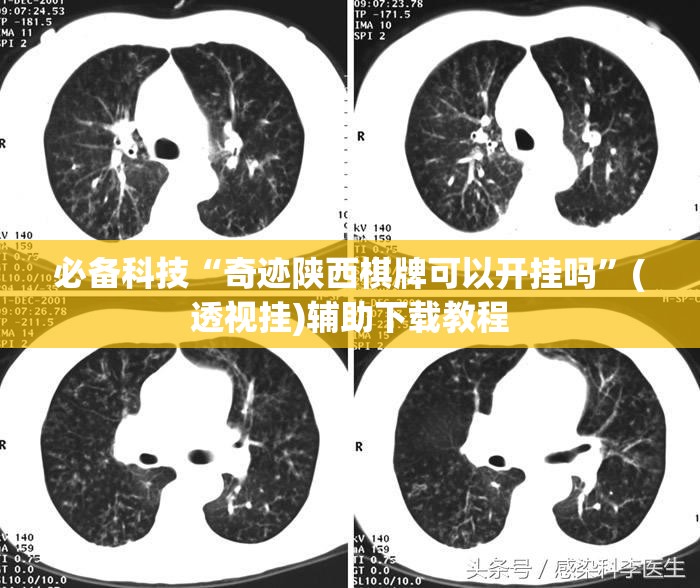 必备科技“奇迹陕西棋牌可以开挂吗”(透视挂)辅助下载教程