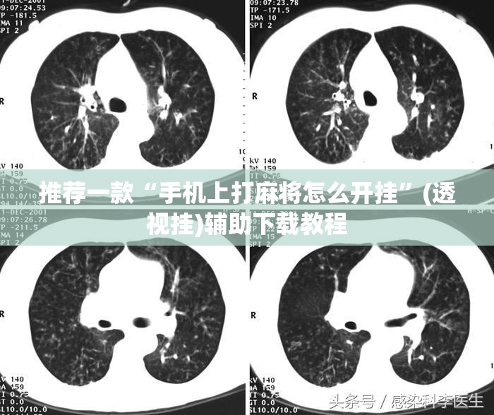 推荐一款“手机上打麻将怎么开挂”(透视挂)辅助下载教程