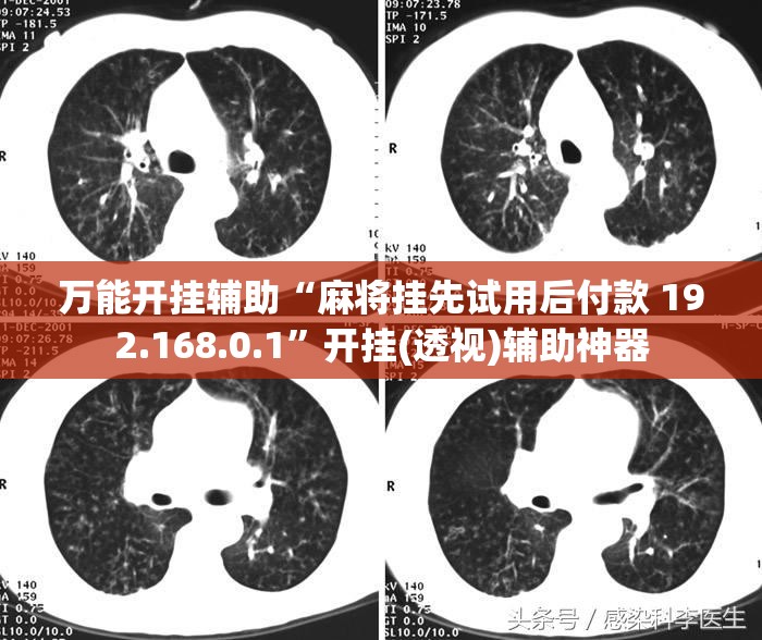 万能开挂辅助“麻将挂先试用后付款 192.168.0.1”开挂(透视)辅助神器