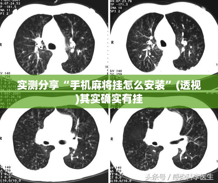 实测分享“手机麻将挂怎么安装	”(透视)其实确实有挂