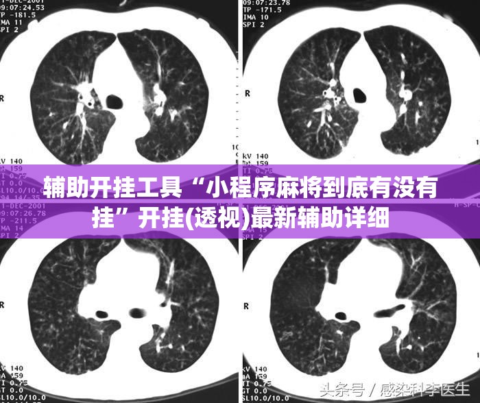 辅助开挂工具“小程序麻将到底有没有挂”开挂(透视)最新辅助详细