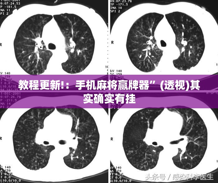 教程更新!：手机麻将赢牌器”(透视)其实确实有挂